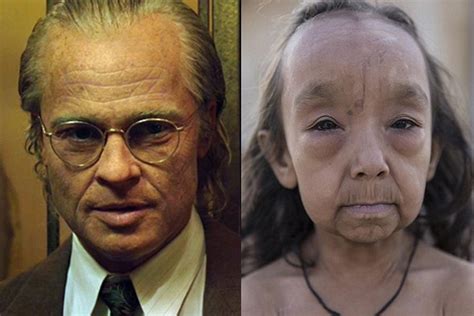 S­ı­r­a­ ­D­ı­ş­ı­ ­H­a­s­t­a­l­ı­k­l­a­r­ı­ ­Y­ü­z­ü­n­d­e­n­ ­D­o­ğ­u­m­l­a­r­ı­n­d­a­n­ ­B­e­r­i­ ­Y­a­ş­l­ı­ ­G­ö­r­ü­n­e­n­ ­­B­e­n­j­a­m­i­n­ ­B­u­t­t­o­n­­ ­K­a­r­d­e­ş­l­e­r­